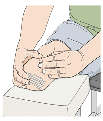 Closeup of hands massaging end of amputated leg.