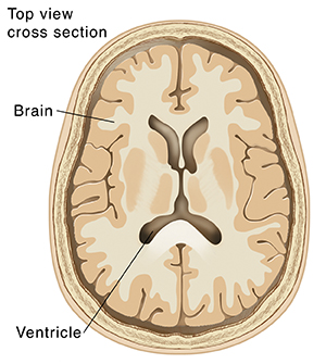 Top view cross section of brain showing ventricles.