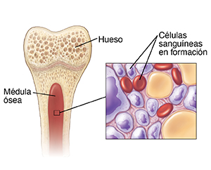 Corte transversal de un hueso donde puede verse la médula ósea y un recuadro con los componentes de la sangre en la médula ósea.